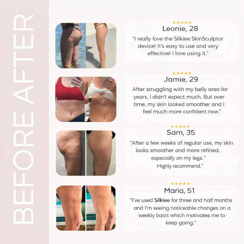 TrendCute SkinSculpt™ Body Sculpting Device for Firmer, Smoother-Looking Skin