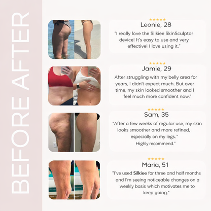 TrendCute SkinSculpt™ Body Sculpting Device for Firmer, Smoother-Looking Skin